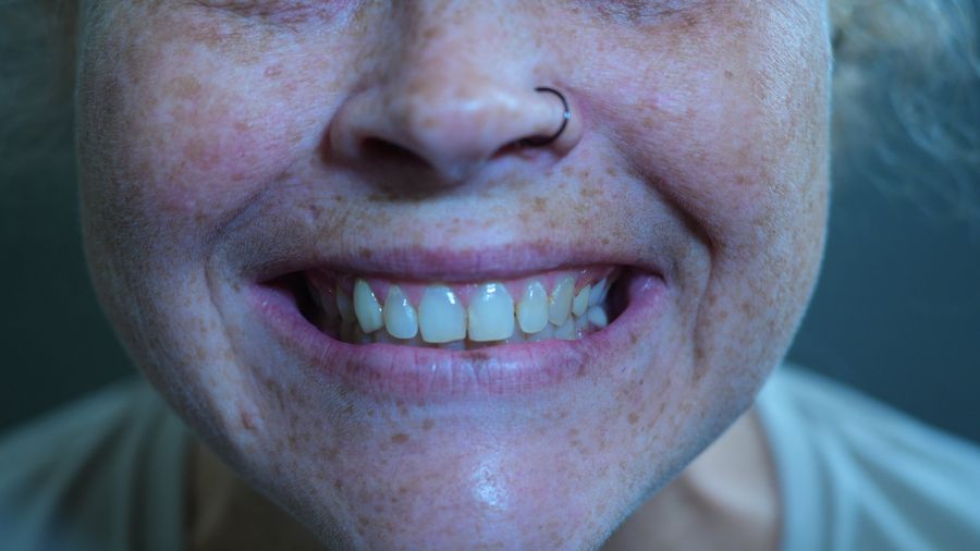 Close-up of a smiling patient’s teeth
